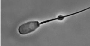 Samenzelle mit Plasmatropfen am Spermienschwanz. © Waberski